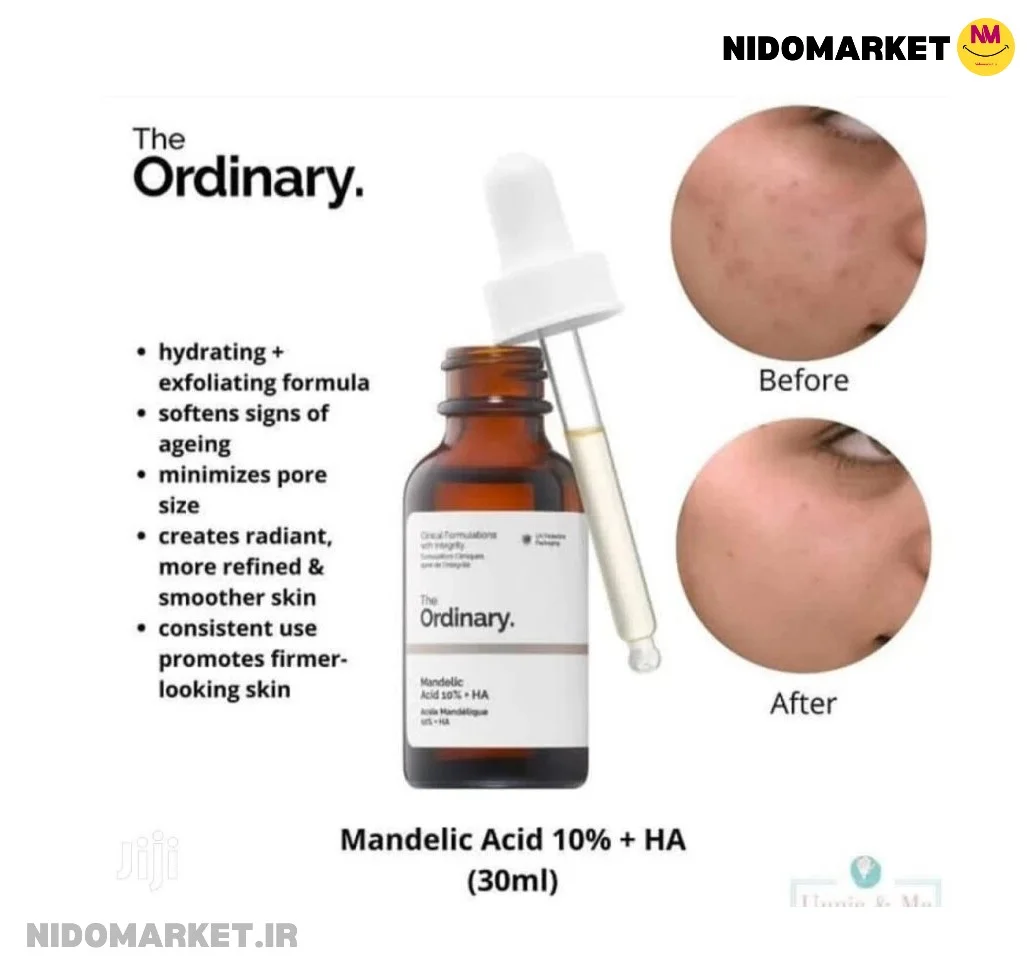 ماندلیک اسید اوردینری ماندلیک اسید اوردینری