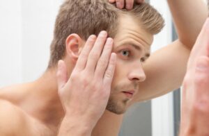 ریزش مو نیدومارکت